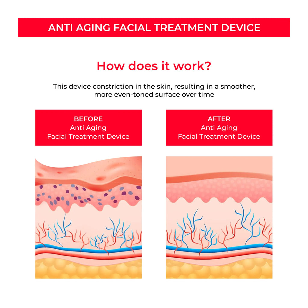 The Skinstiq Pro — At-Home Facial Rejuvenation System