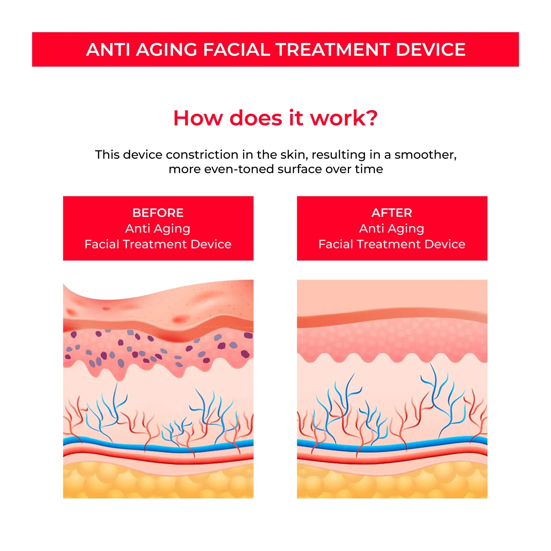 The Skinstiq Pro — At-Home Facial Rejuvenation System