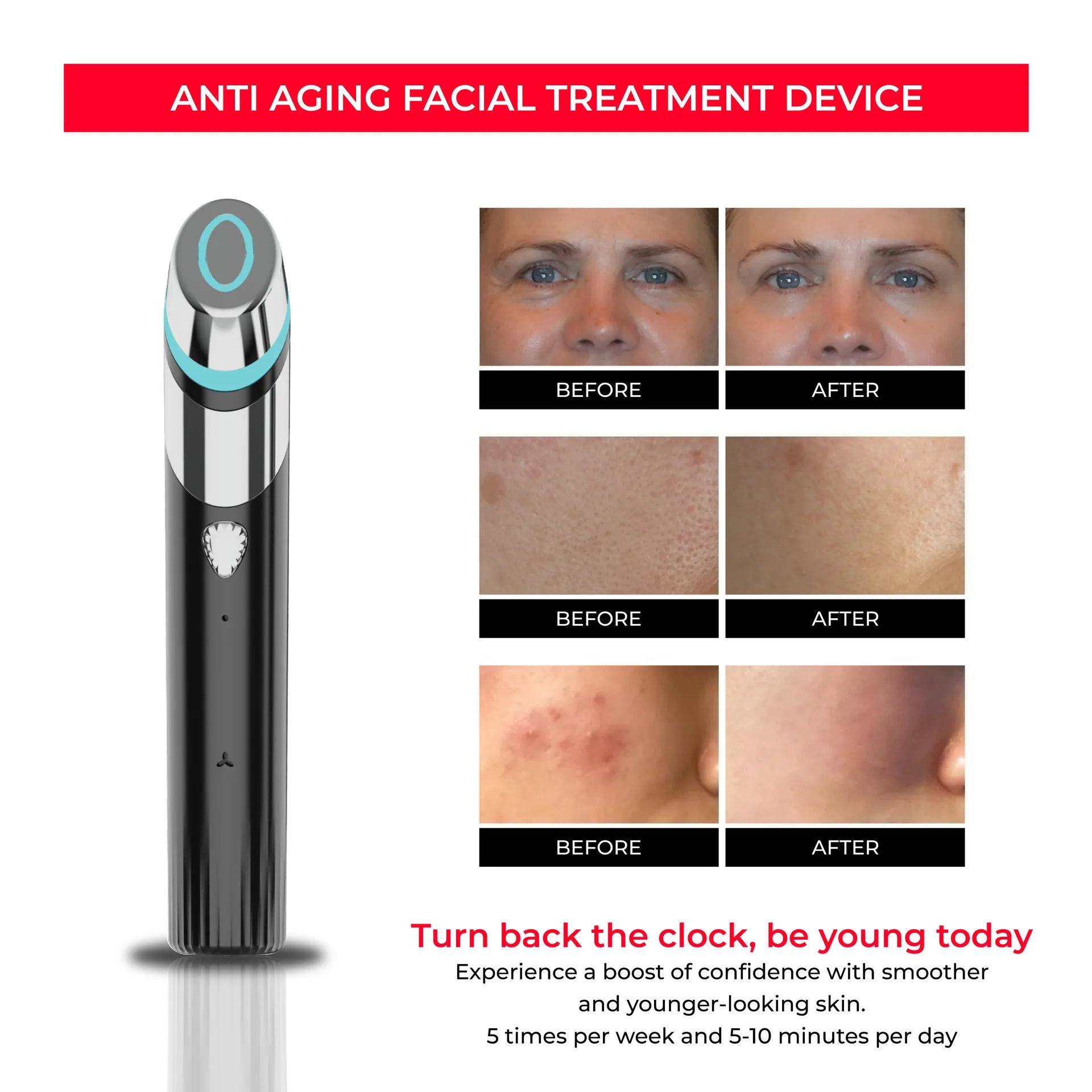 The Skinstiq Pro — At-Home Facial Rejuvenation System